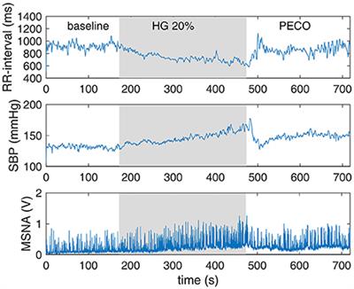 Cardiac Baroreflex Variability and Resetting during Sustained Mild Effort